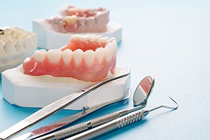 a plaster mold of a mouth with a denture on it