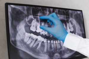 a dentist pointing at an X-ray